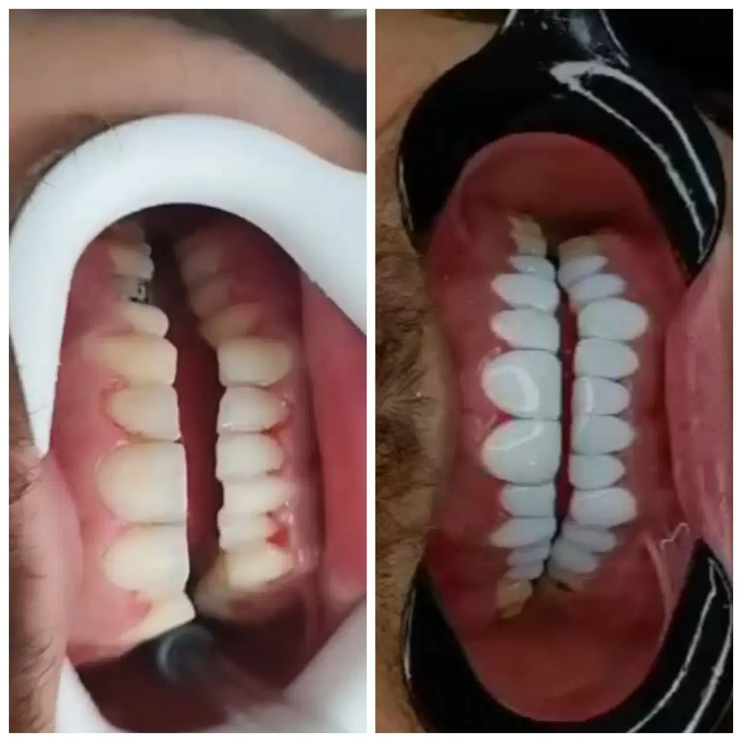 ترمیم و زیبایی|خدمات آرایشگری و زیبایی|یاسوج, |دیوار