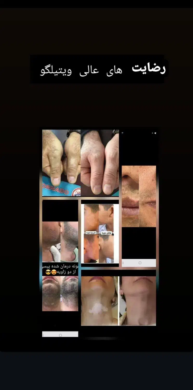 آموزش روغن درمانی ویژه|خدمات آموزشی|خاش, |دیوار