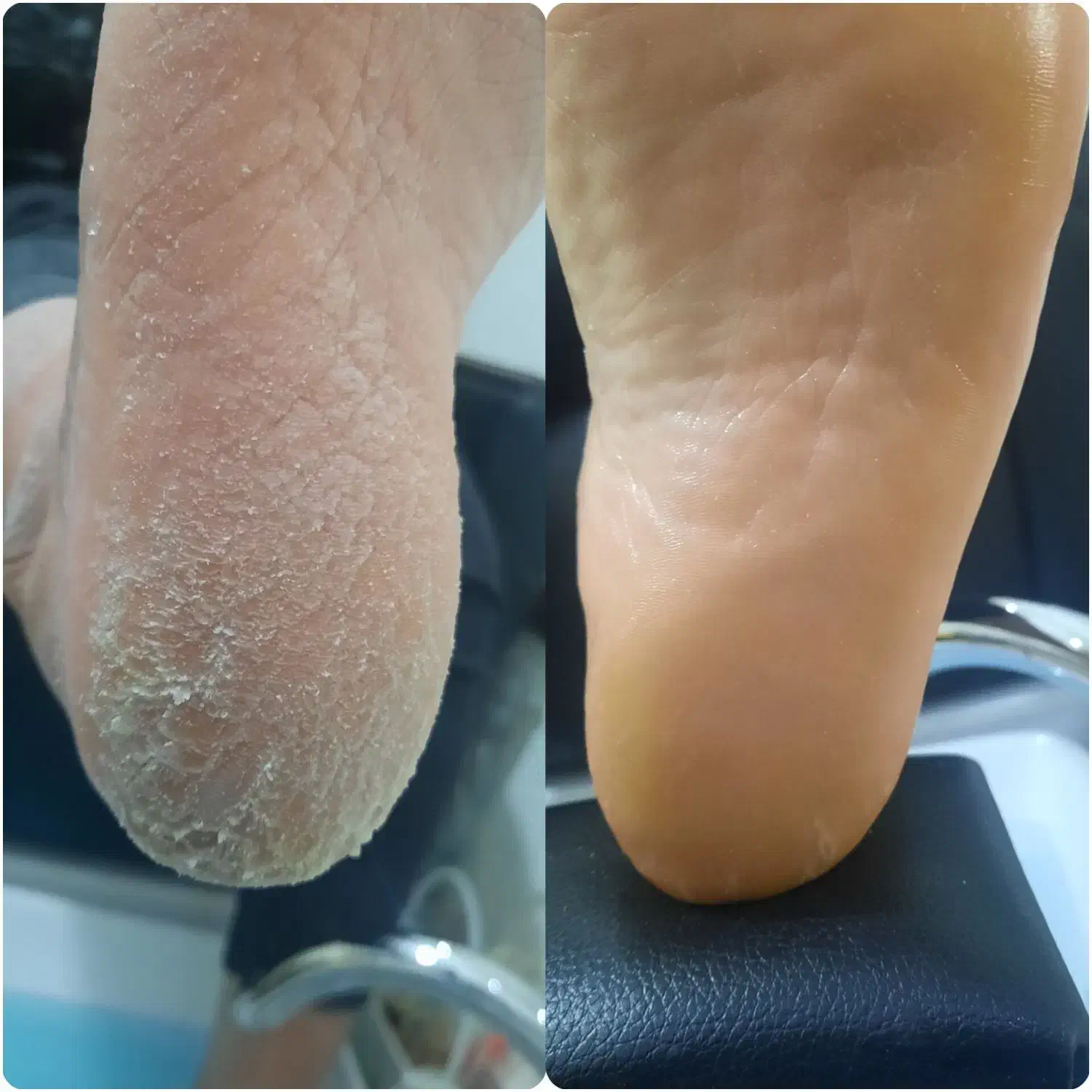 پدیکور و کفسابی پا|خدمات آرایشگری و زیبایی|شاهینشهر, خانه کارگر|دیوار