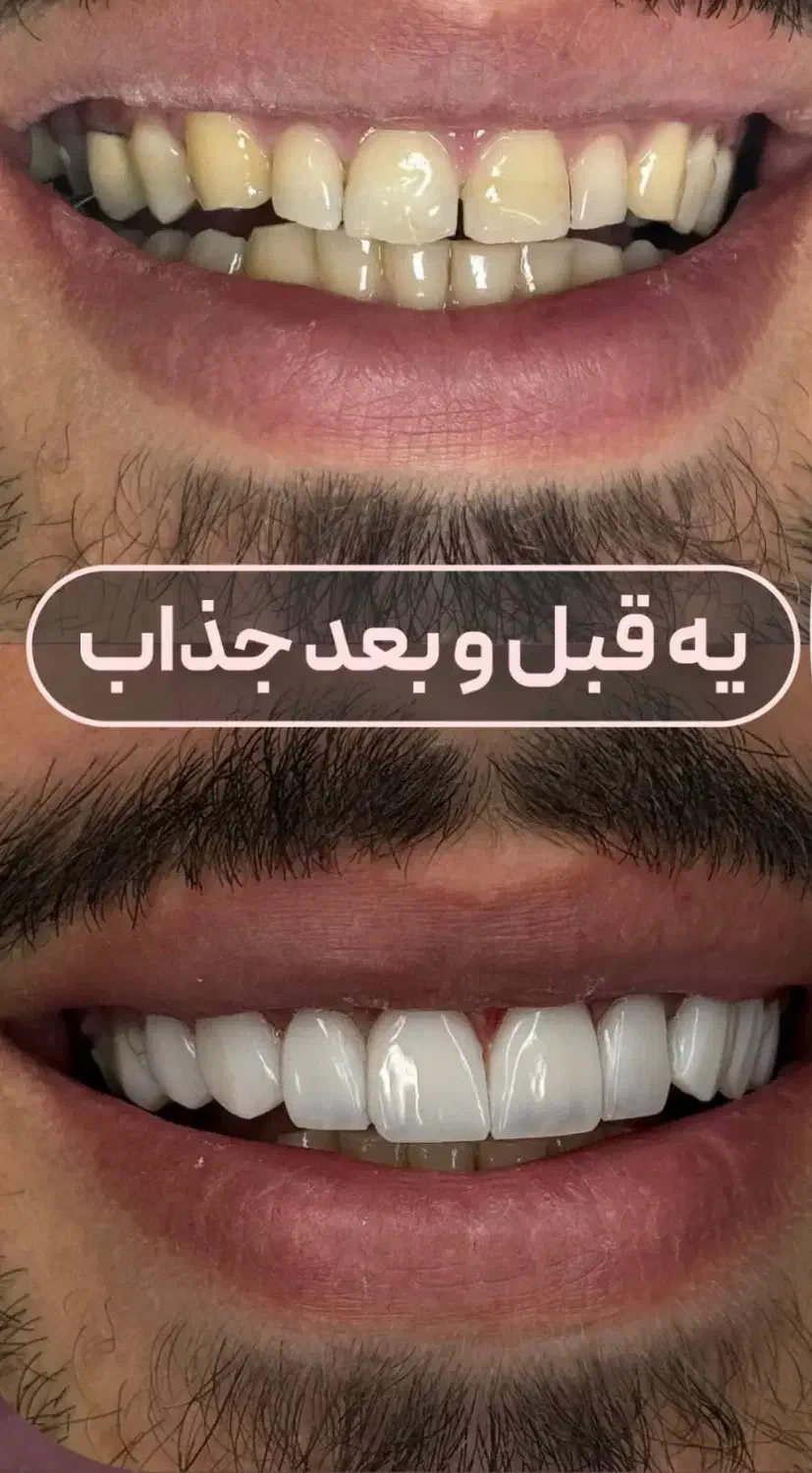 جشنواره کامپوزیت از ۵۹۰|خدمات آرایشگری و زیبایی|اهواز, کیانپارس |دیوار
