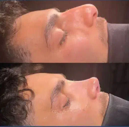 عمل جراحی بینی و ترمیمی در تهران|خدمات آرایشگری و زیبایی|قم, آزادگان|دیوار