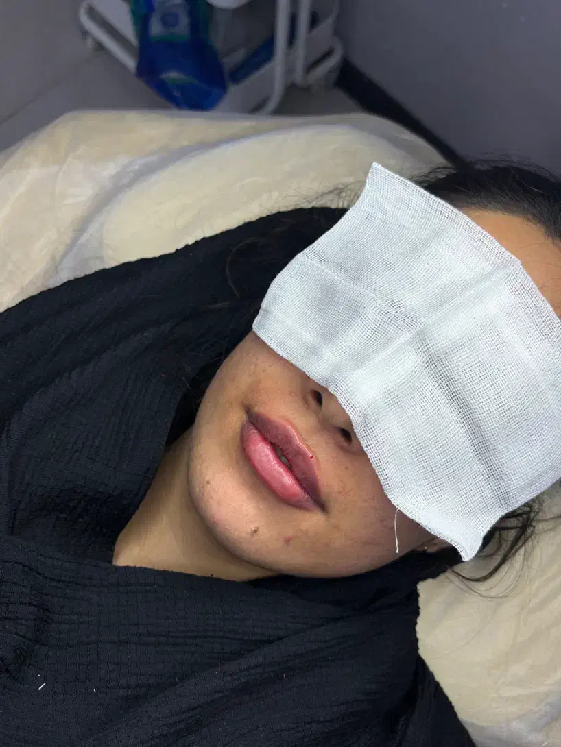 تزریق ژل و بوتاکس اف تا فردافقط۹۸۰|خدمات آرایشگری و زیبایی|یاسوج, |دیوار