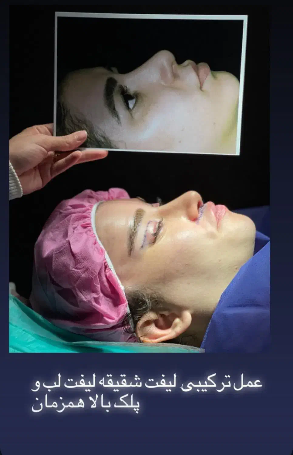 جشنواره بلفارو پلاستی پلک فقط 8500|خدمات آرایشگری و زیبایی|اصفهان, بهار آزادی|دیوار