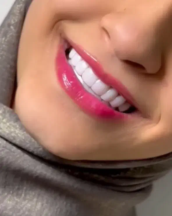 خدمات دندانپزشکی با قیمت مناسب|خدمات آرایشگری و زیبایی|گنبد کاووس, |دیوار