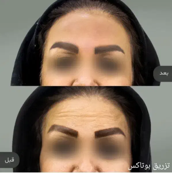 تخفیف ویژه شب یلدا خدمات زیبایی|خدمات آرایشگری و زیبایی|مشهد, کوشش|دیوار