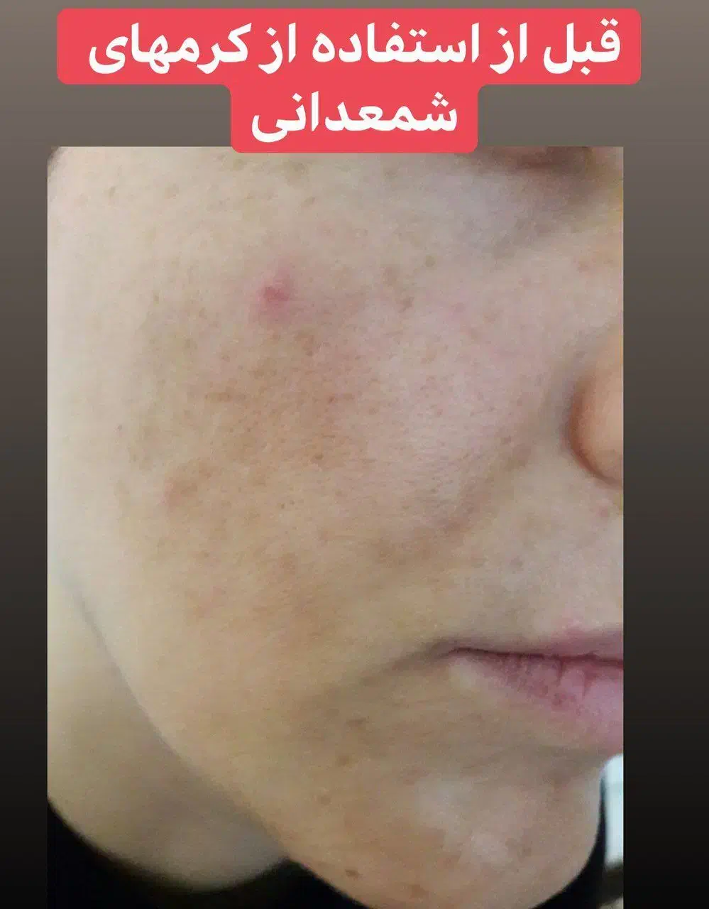 زیبا شو|آرایشی، بهداشتی، درمانی|ایلام, |دیوار