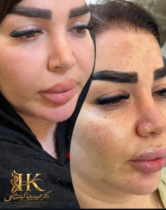 پی آر پی تخصصی /  توسط پزشک متخصص|خدمات زیبایی و سلامت|مشهد, شهید فرامرز عباسی|دیوار