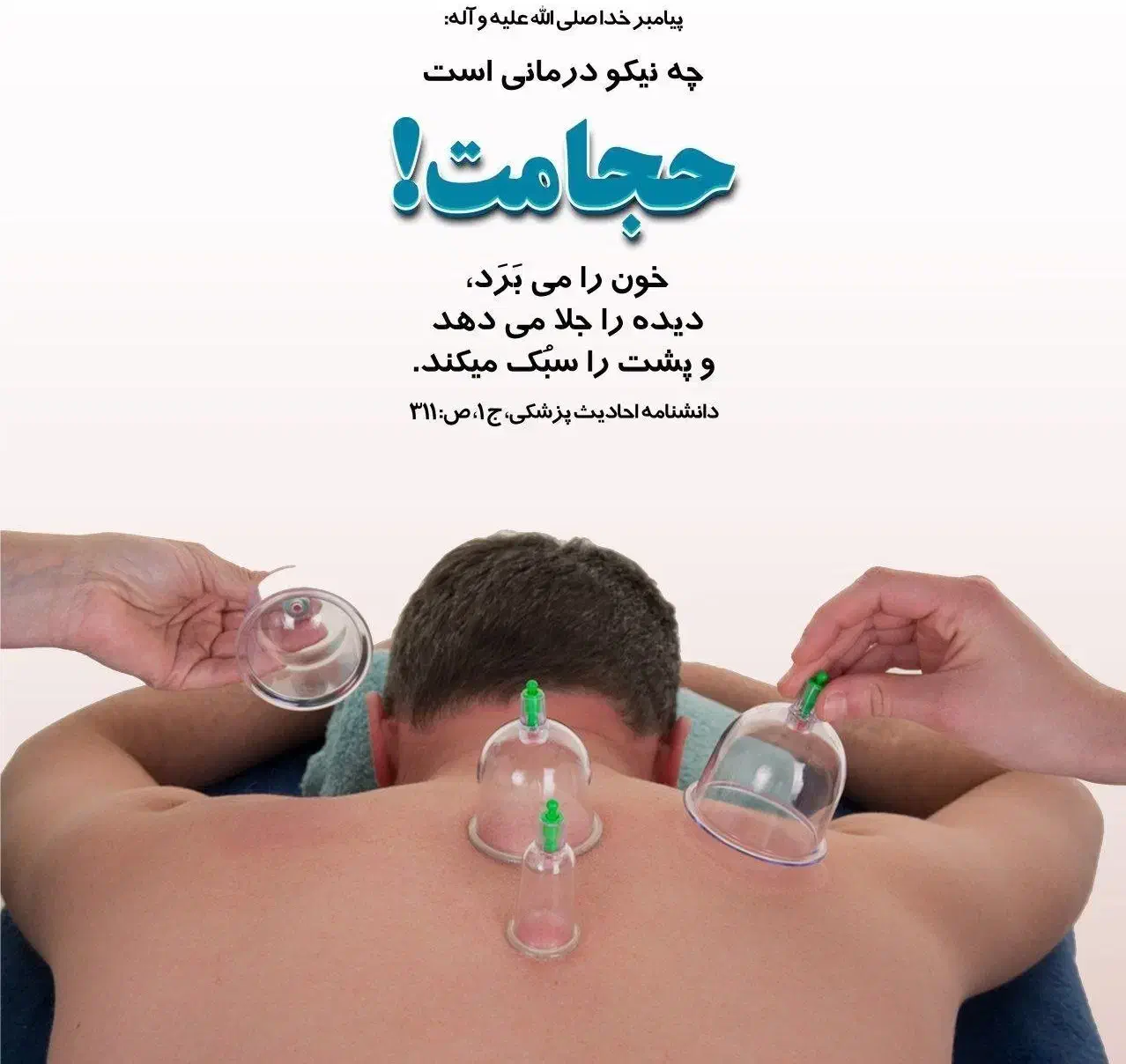 حجامت در مطب پزشک فقط ۲۵۰ تومان|خدمات آرایشگری و زیبایی|اصفهان, سودان|دیوار