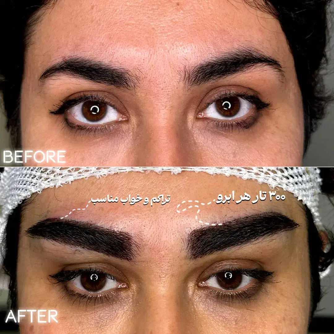 کاشت ابرو|خدمات آرایشگری و زیبایی|اندیشه, اندیشه فاز ۱|دیوار