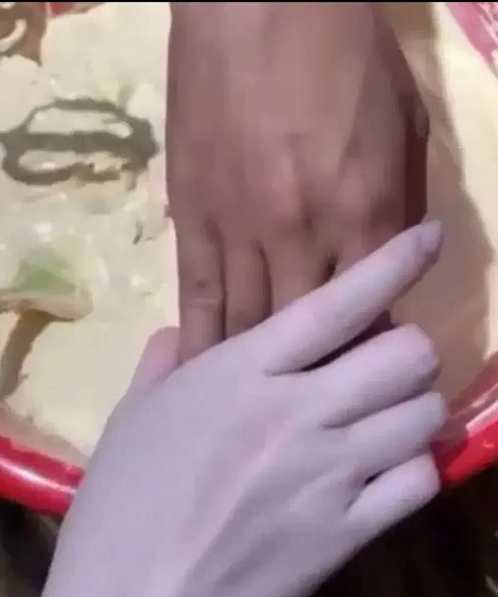 فرمول کرم لکه بردار صورت و دستو پا|آرایشی، بهداشتی، درمانی|رشت, باهنر|دیوار