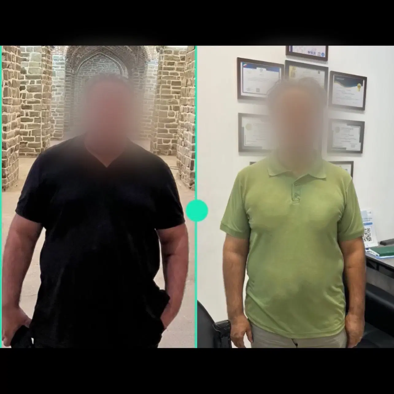لاغری با آمپول (اسپارتینا تحت نظر پزشک) ۶۰٪ تخفیف|خدمات زیبایی و سلامت|مشهد, ویلاشهر|دیوار
