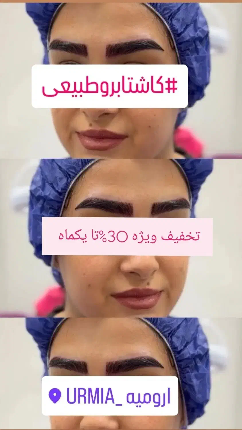 کاشت مو و کاشت ابرو اقساطی و تضمینی|خدمات آرایشگری و زیبایی|ارومیه, |دیوار