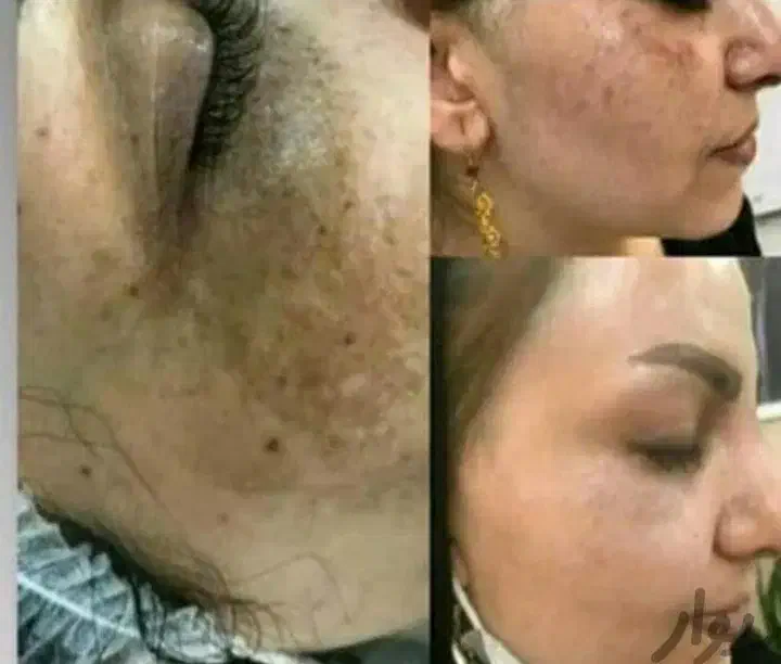 کرم معجزه شب اصل رفع لک وجوش وسفیدشدن پوست|آرایشی، بهداشتی، درمانی|قم, چهار مردان|دیوار