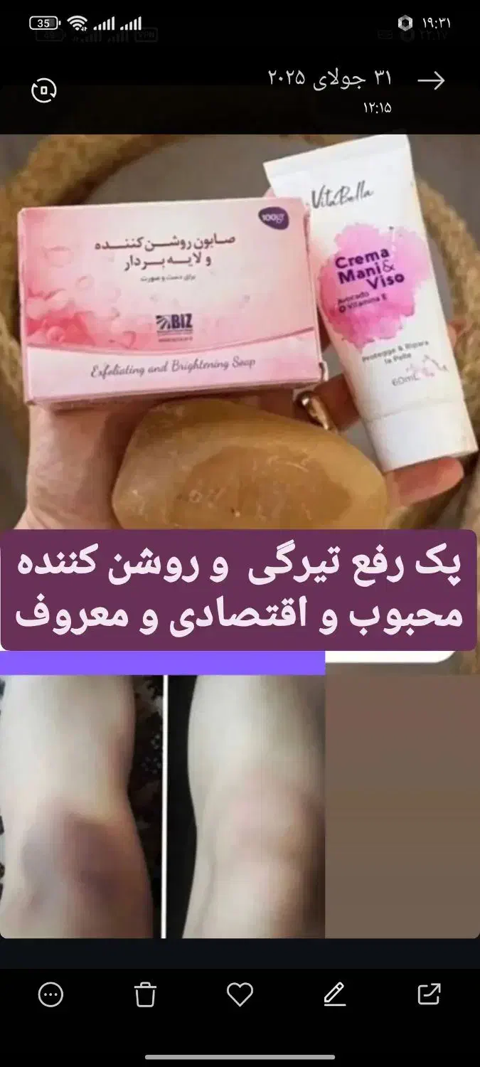 پک روشنایی ورفع تیرگی صورت وبدن|حراج|زرند, |دیوار