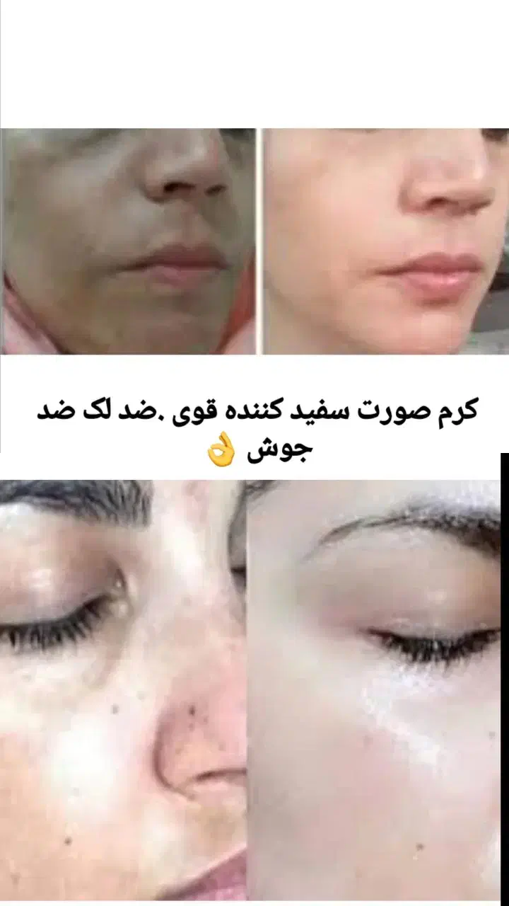 کرم صورت و دست وپا|آرایشی، بهداشتی، درمانی|بندرعباس, |دیوار