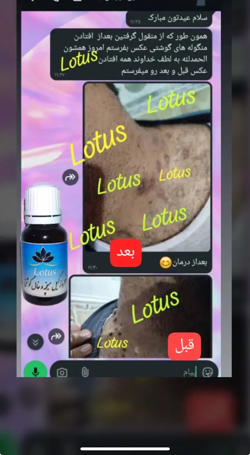 کرم مروارید بیواکوا|آرایشی، بهداشتی، درمانی|صدرا-فارس, فاز ۱|دیوار