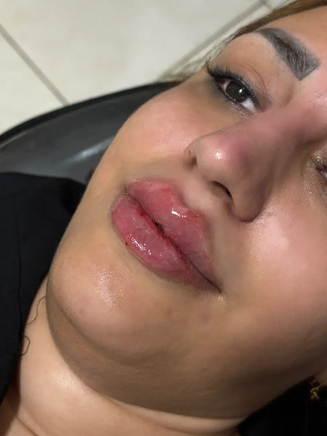 ژل و بوتاکس فرنیا بیوتی|خدمات آرایشگری و زیبایی|شهریار, شهرک وائین|دیوار