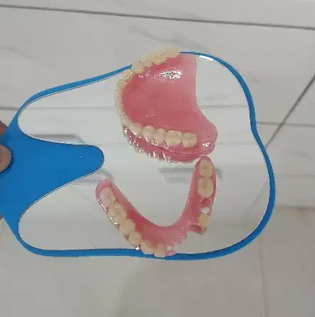 پروتز متحرک دندان|آرایشی، بهداشتی، درمانی|گنبد کاووس, |دیوار