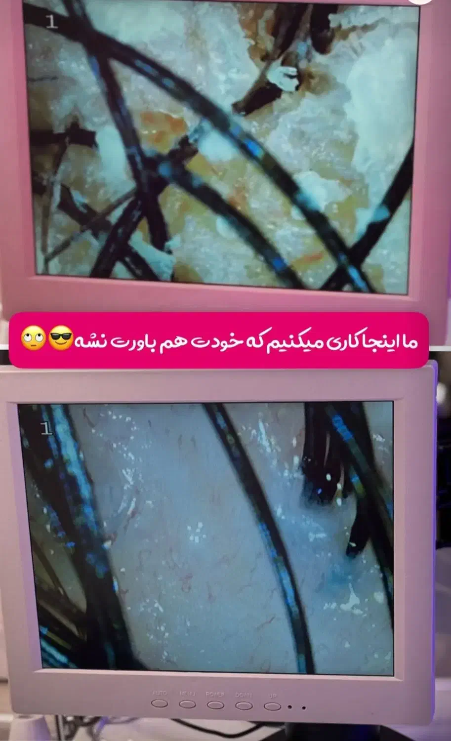 درمان تخصصی ریزش مو و رفع کم پشتی مو|خدمات آرایشگری و زیبایی|قم, صدوق|دیوار