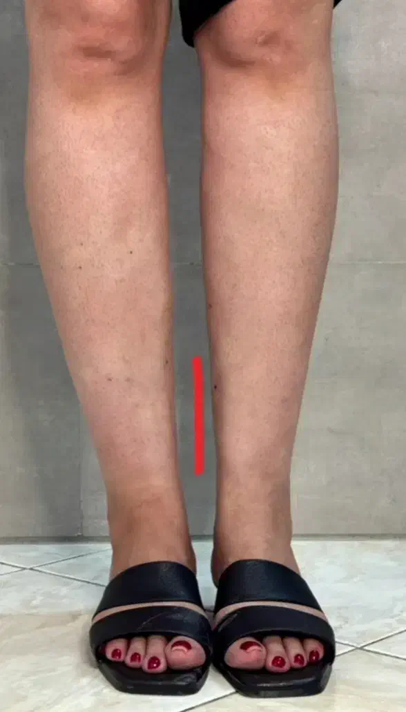 فیلرباسن هیپ دیپ ۱۲۰سیسی ۱۲میلیون تا آخر مهر|آرایشی، بهداشتی، درمانی|تبریز, |دیوار