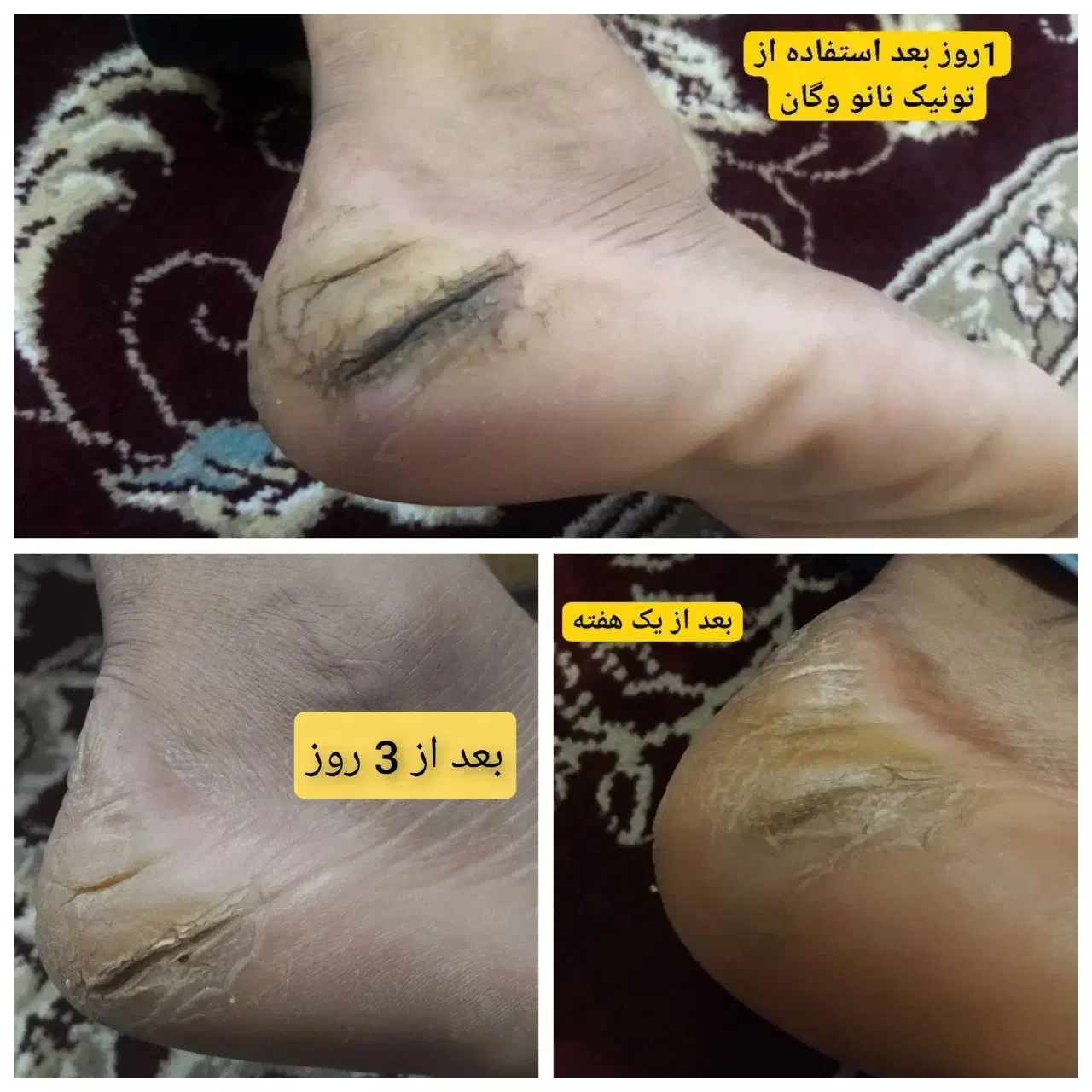 تونیک نانو وگان یا آچار فرانسه ی پوست|آرایشی، بهداشتی، درمانی|قم, اسمعیل آباد|دیوار