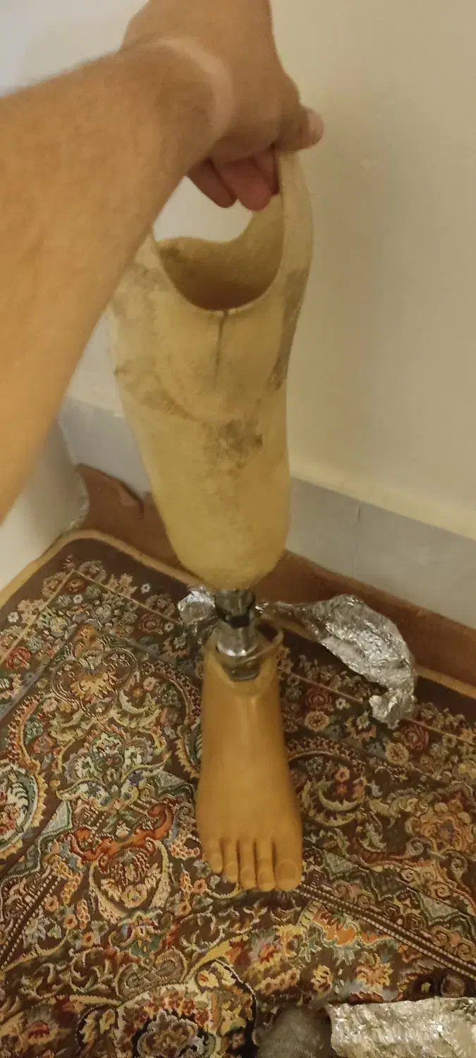 فروش پا مصنوعی پروتزی فولادی در حد نو|پزشکی|اهواز, کوی مهدیس|دیوار