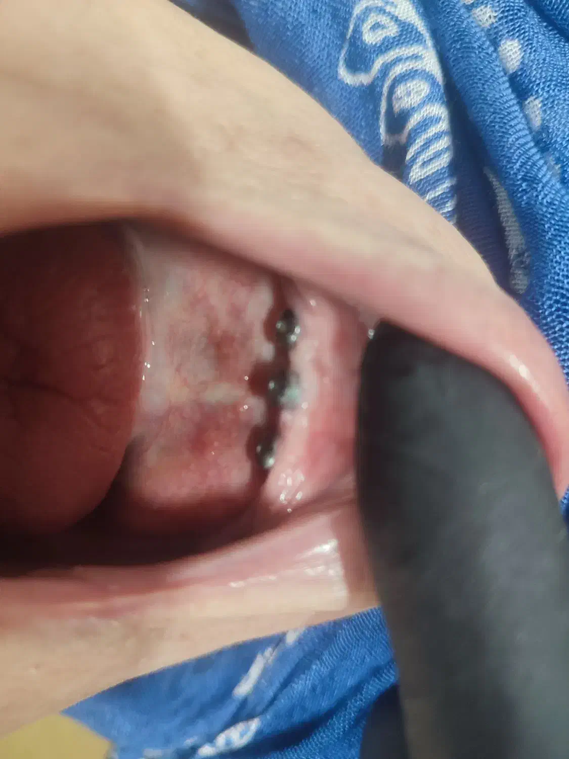 تخفیفات وشرایط اقساطی برای ایمپلنت و پروتز مصنوعی|خدمات آرایشگری و زیبایی|بجنورد, |دیوار