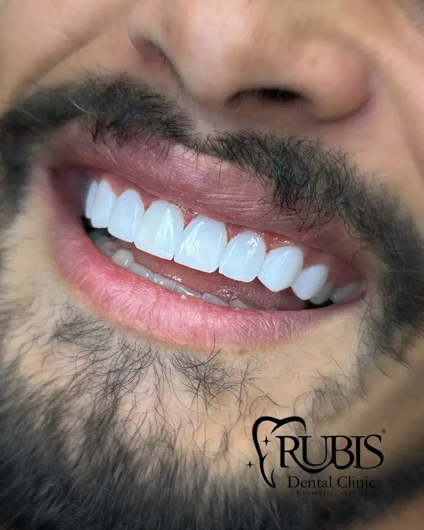 کامپوزیت ارزان|پزشکی|تهران, شهرک خرازی|دیوار