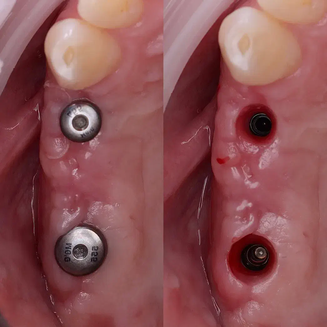 تخفیف و اقساط بلند مدت کلینیک دی|خدمات آرایشگری و زیبایی|آذرشهر, |دیوار