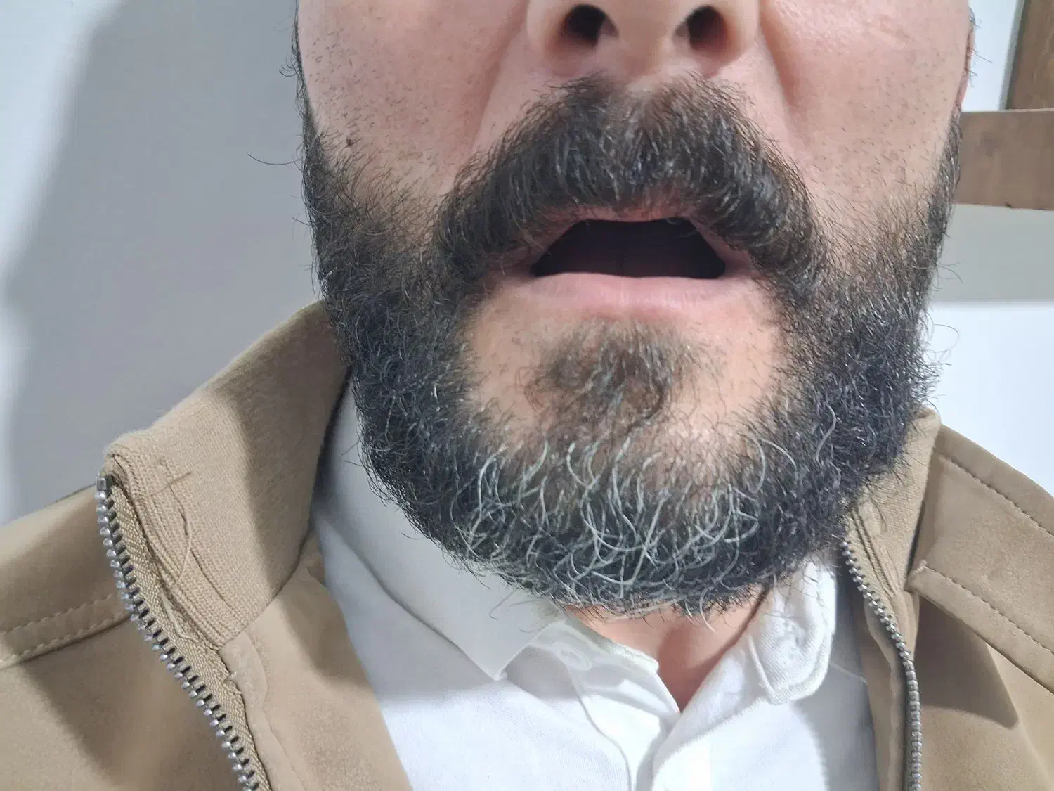 دندانسازی متحرک(شرایط خوب)|خدمات آرایشگری و زیبایی|قیدار, |دیوار