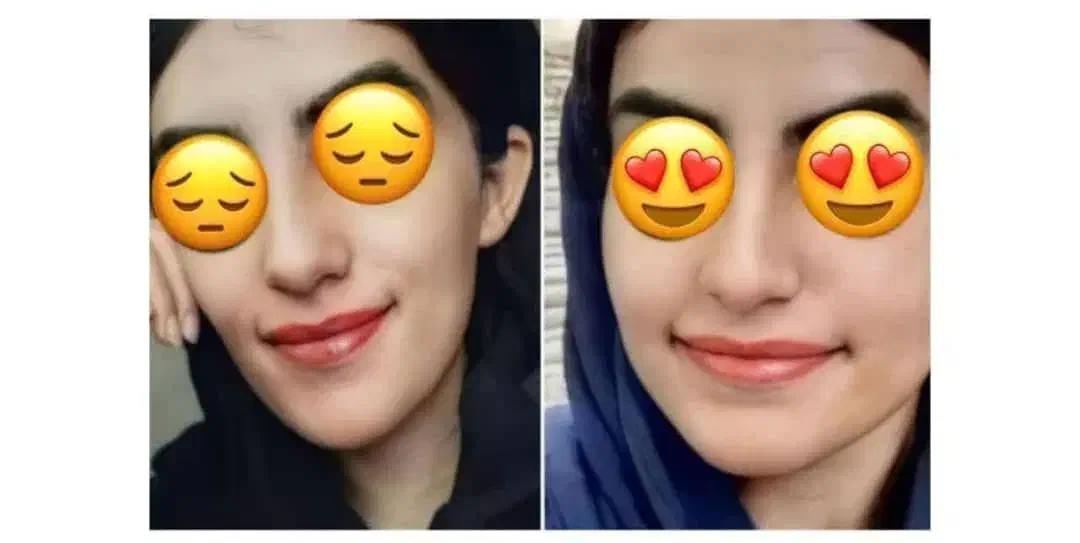 تناسب اندام و زیبایی|آرایشی، بهداشتی، درمانی|شیراز, حافظیه|دیوار