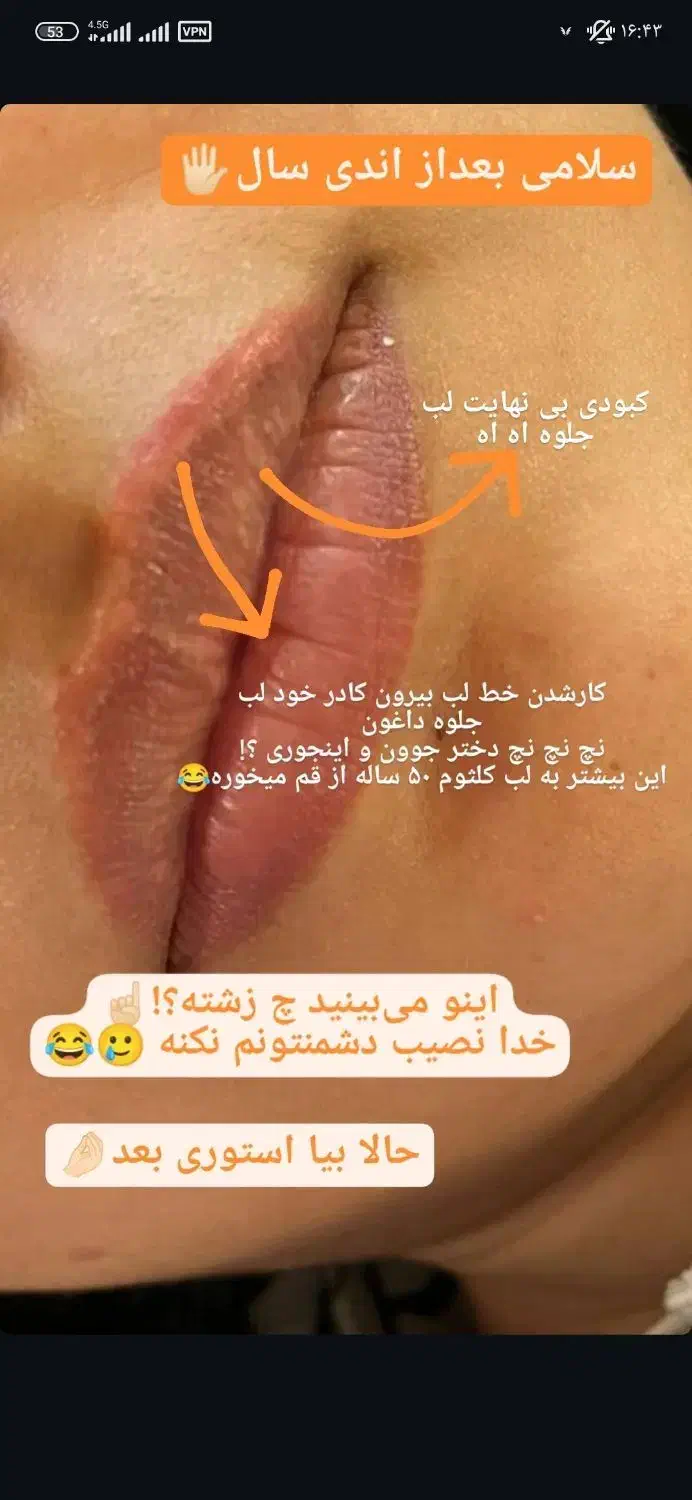 تخفیف یلدایی تتو بدن آرایش دائم ریموو و اموزش ها|خدمات آرایشگری و زیبایی|اردکان, |دیوار