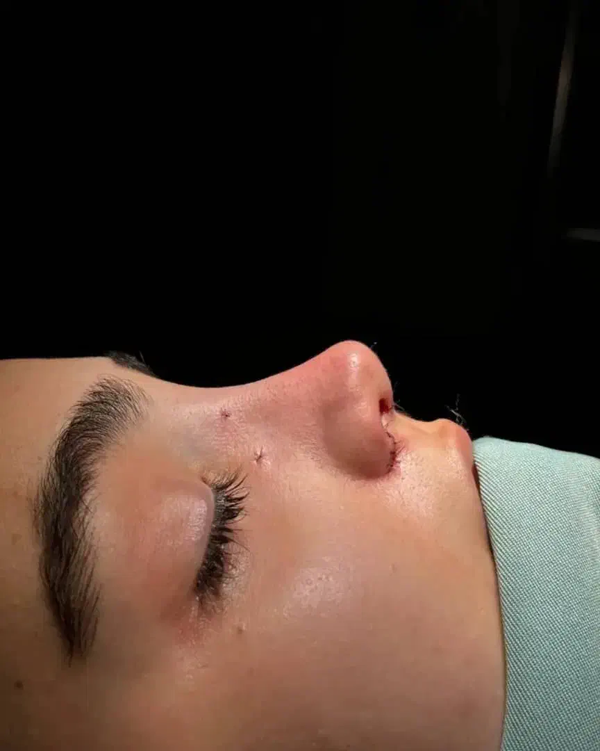 اف ویژه جراحی بینی در اهواز|خدمات آرایشگری و زیبایی|سوسنگرد, |دیوار