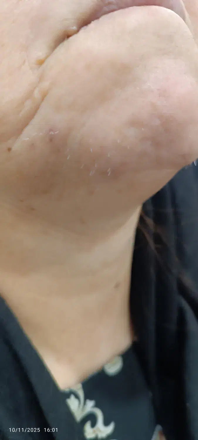 الکترولیز موی سفید وبرداشتن خال و زگیل ومیخچه|خدمات آرایشگری و زیبایی|یاسوج, |دیوار