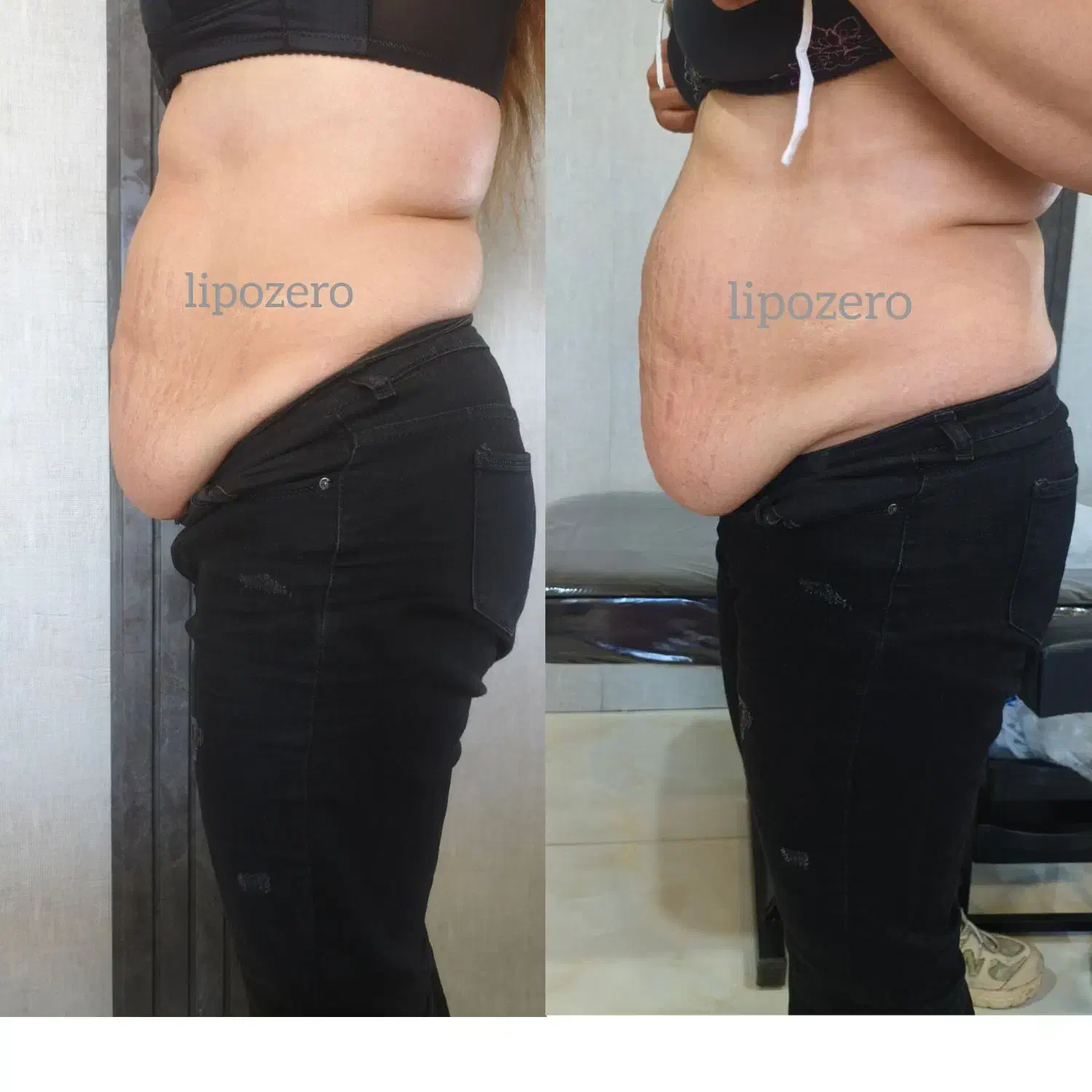 دستگاه لاغری وجوانسازی لیپوزیرو|خدمات آرایشگری و زیبایی|فارسان, |دیوار