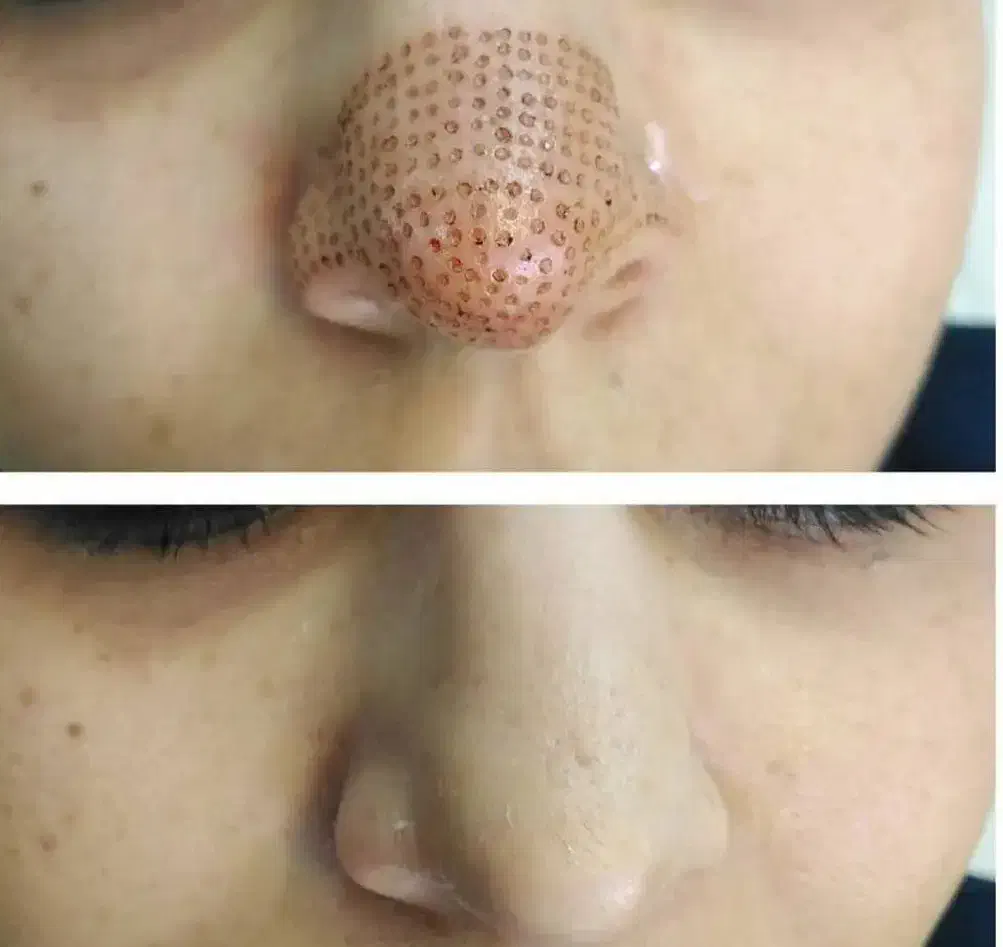 خدمات آرایش دائم و ریمو|خدمات آرایشگری و زیبایی|اردبیل, |دیوار