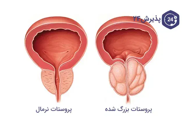 روغن پروستات|خوردنی و آشامیدنی|قم, سیدان|دیوار