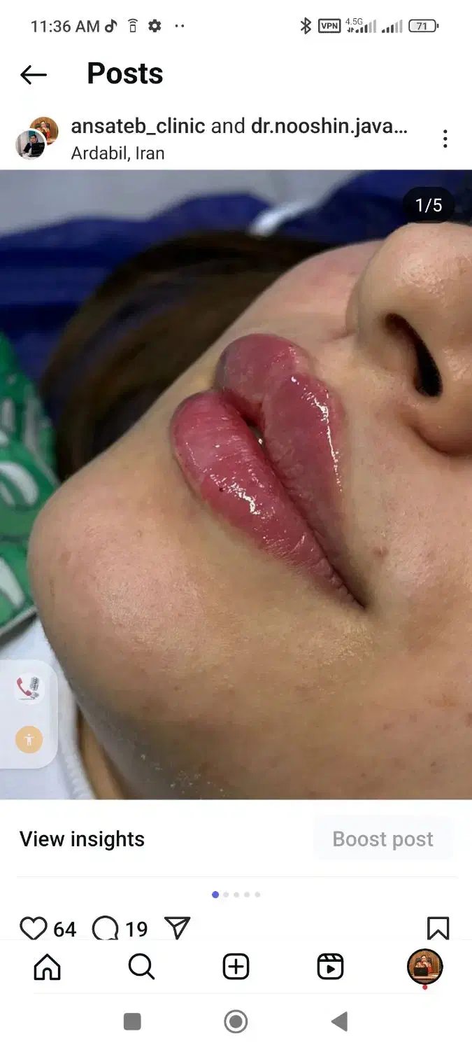 کلینک زیبایی|خدمات آرایشگری و زیبایی|اردبیل, |دیوار