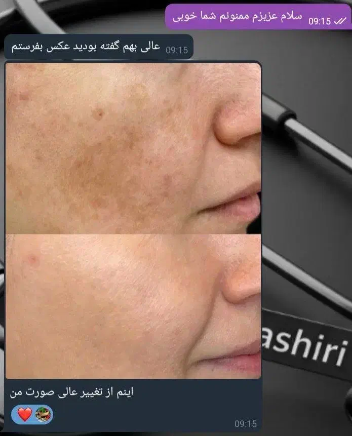 روغن های معجزه گر کاژان|آرایشی، بهداشتی، درمانی|تاکستان, |دیوار