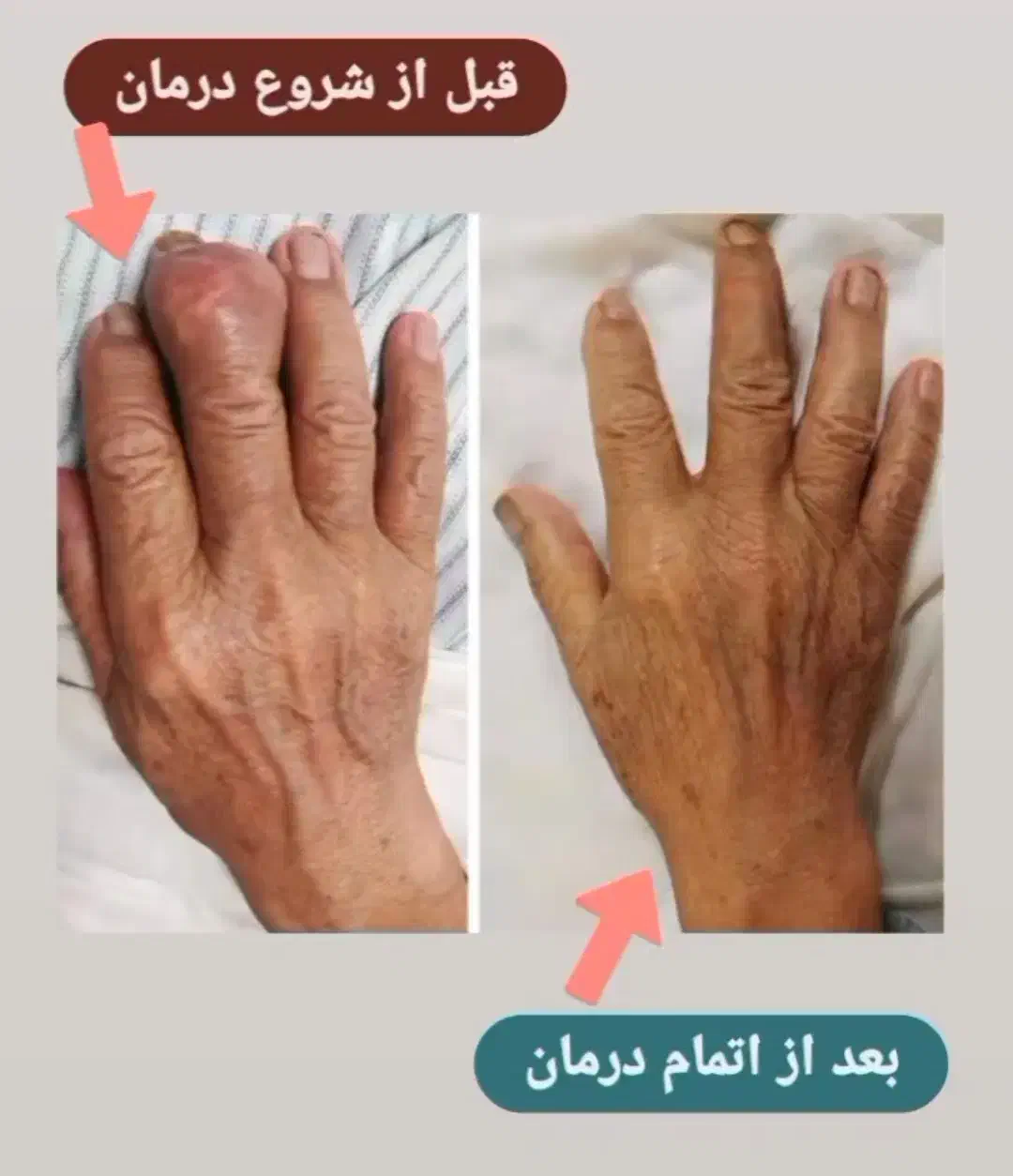 درمانگر بیماری روماتیسم و درد مفاصل|خدمات آرایشگری و زیبایی|اصفهان, شهرک سلامت|دیوار