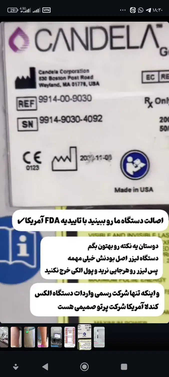 لیزر کندلا اصلی تضمینی با تخفیف در کلینیک روشا|خدمات آرایشگری و زیبایی|کوهدشت, |دیوار