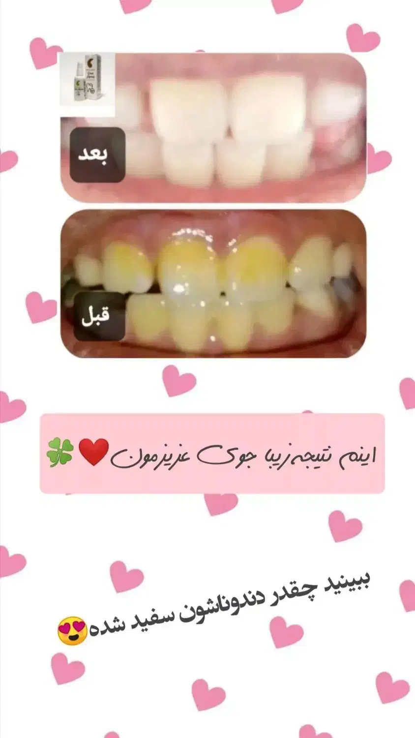 برای استفاده شخصی پک دهان دندان|آرایشی، بهداشتی، درمانی|گلوگاه بابل (گلیا), |دیوار