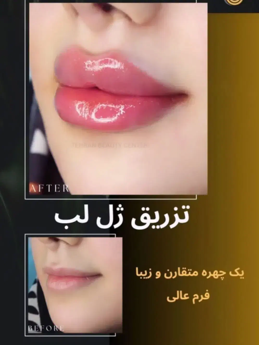 کاشت مو و ابرو / بوتاکس / چربی ژل /کلینیک /زیبایی|خدمات آرایشگری و زیبایی|بوکان, |دیوار