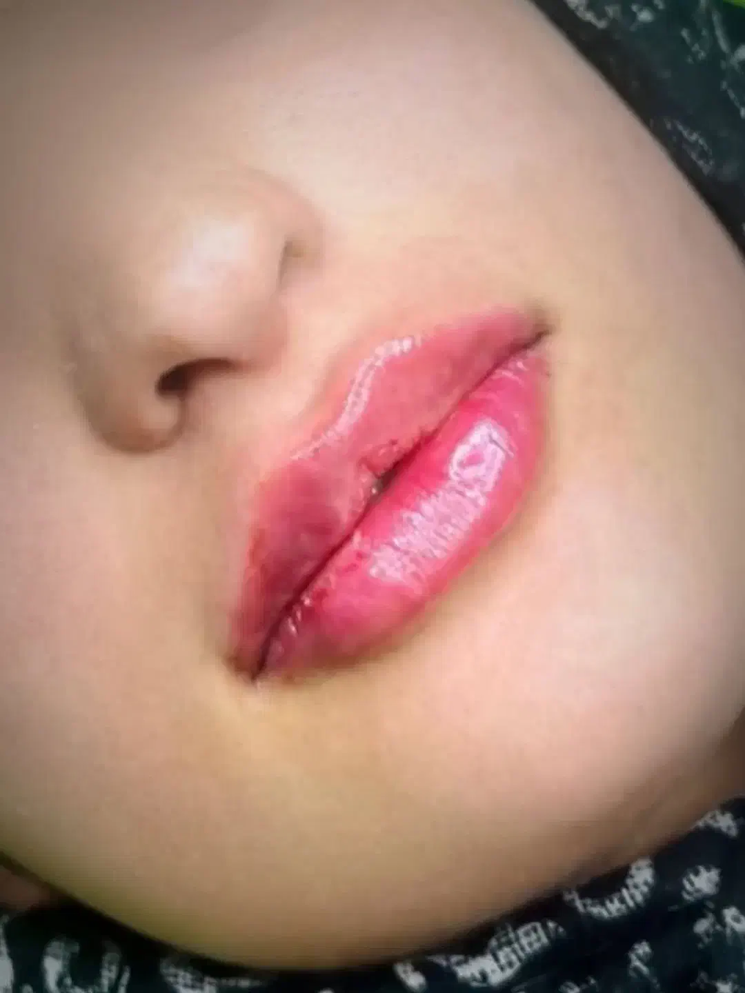 اف ویژه تمام خدمات زیبایی و جراحی در مطب|خدمات آرایشگری و زیبایی|یاسوج, |دیوار