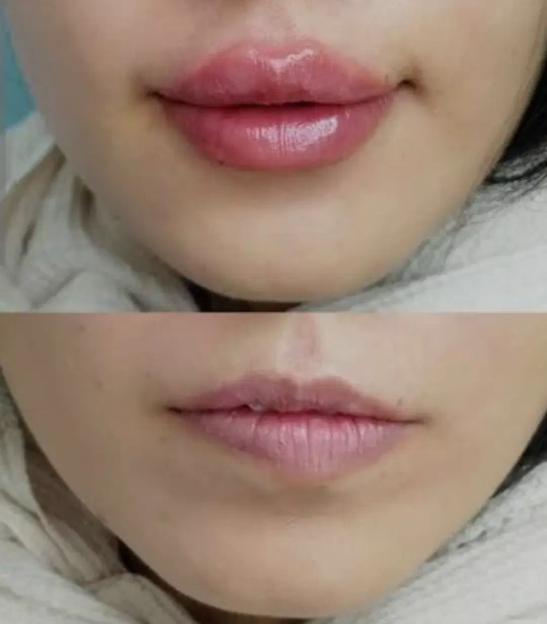 ژل لب،چونه ،آنزیم ،زاویه ،بوتاکس|خدمات آرایشگری و زیبایی|قم, تولید دارو و یخچال|دیوار