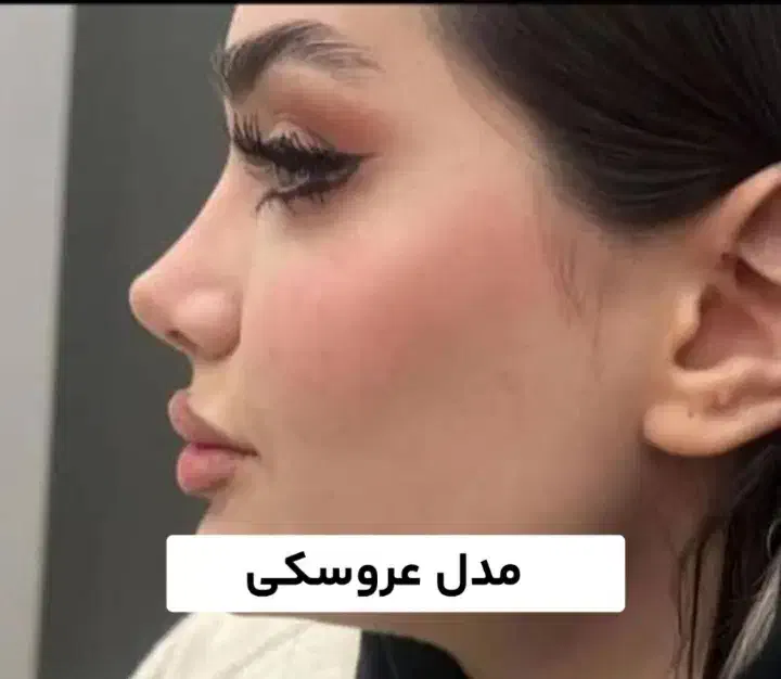 جراحی عمل بینی فقط ۲۳ پلک لیفت صورت پیکرتراشی|خدمات آرایشگری و زیبایی|کرج, مهرویلا جنوبی|دیوار