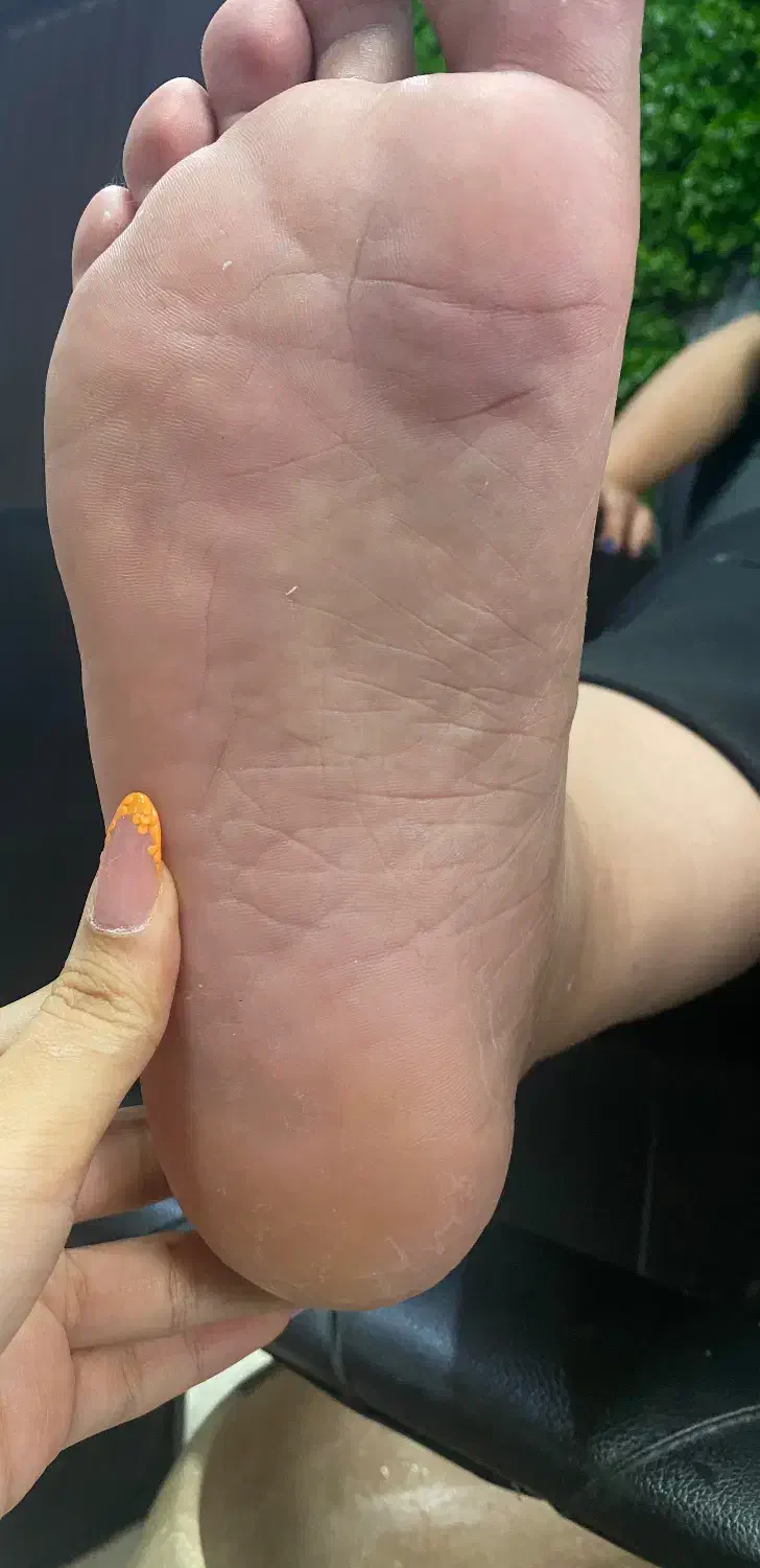 -رفع ترک و پینه پا با تکنیک تخصصی|خدمات آرایشگری و زیبایی|قائم‌شهر, |دیوار