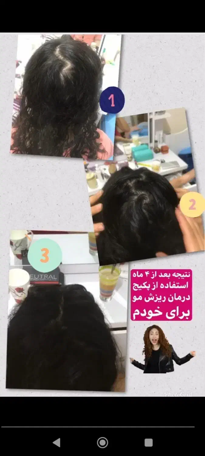 درمان ریزش مو و رویش مجدد مو|آرایشی، بهداشتی، درمانی|شیراز, جمهوری|دیوار