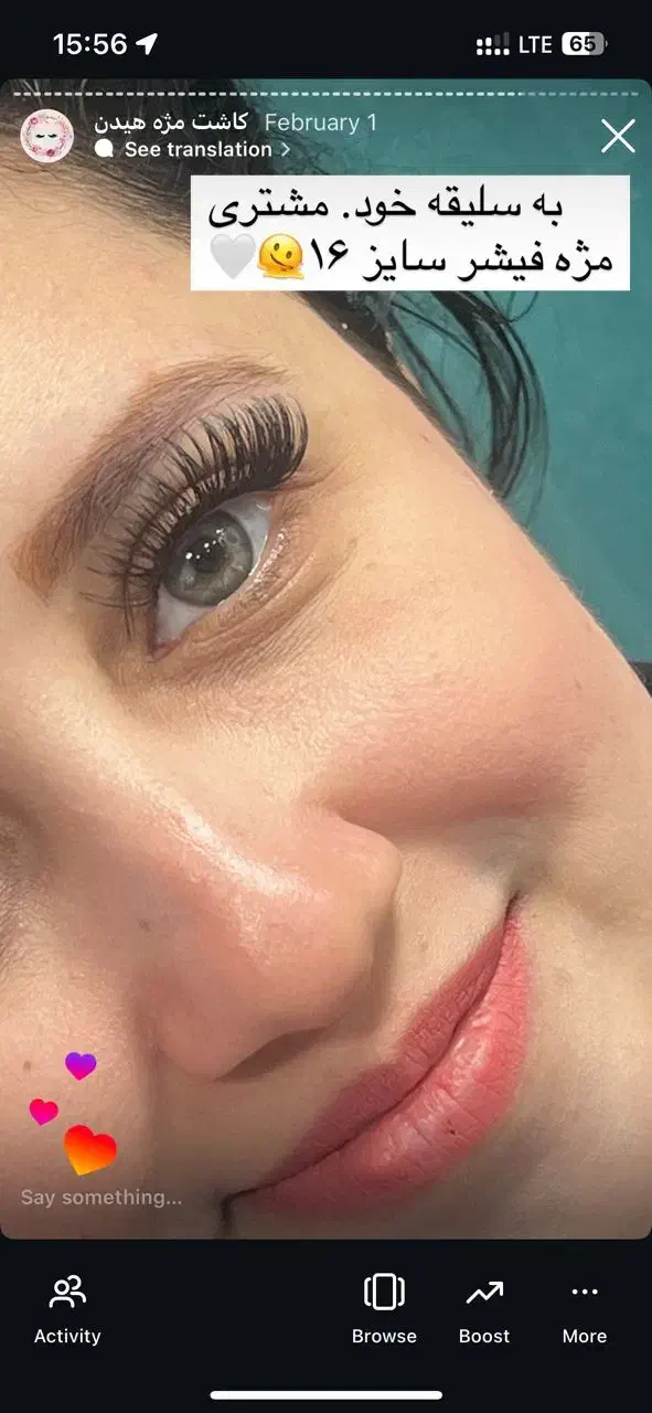 کاشت هیدن فقط 150 تومن|خدمات آرایشگری و زیبایی|رشت, رشتیان|دیوار