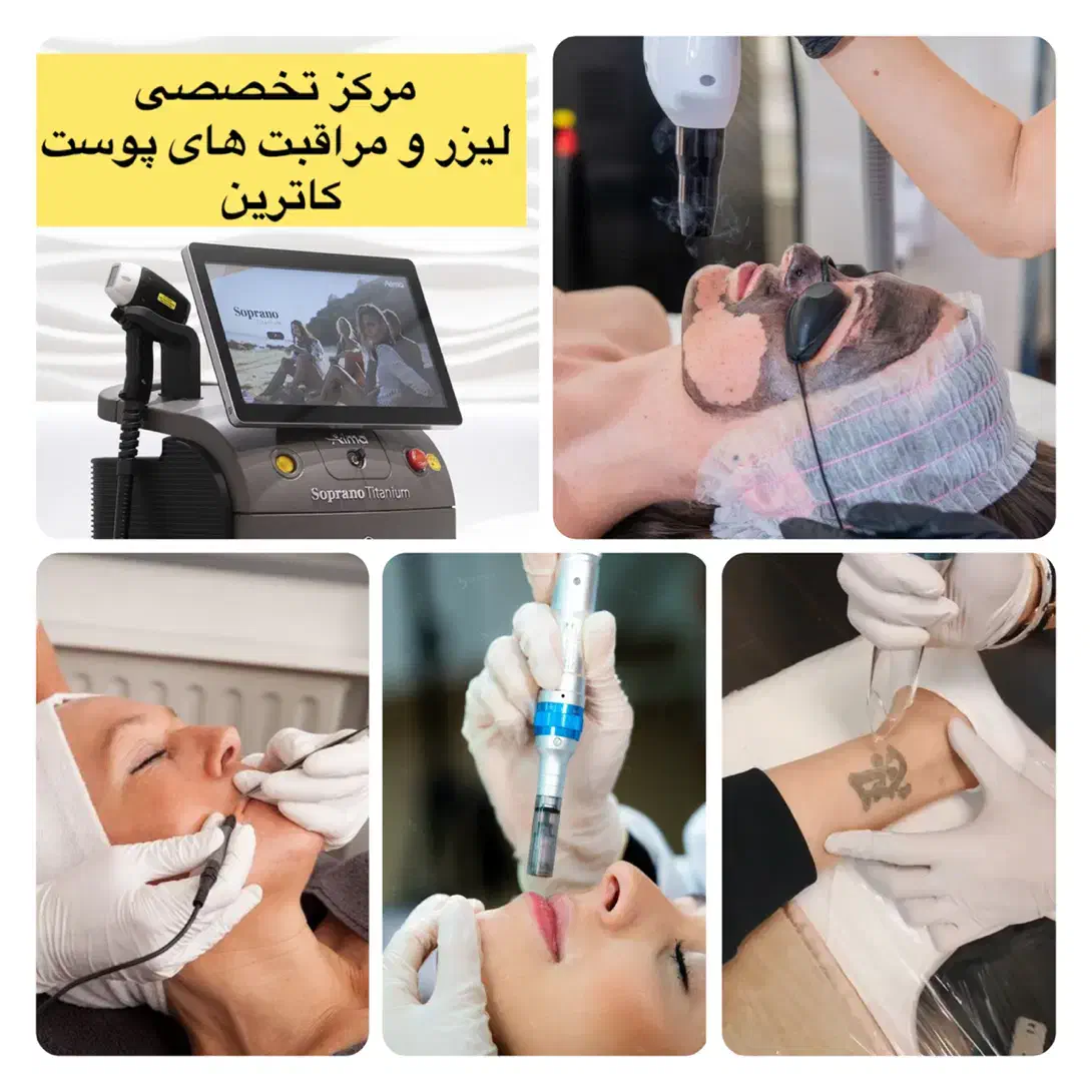 جشنواره تخفیفات لیزر موهای زائد درمرکز لیزر کاترین|خدمات آرایشگری و زیبایی|شاهین‌شهر, فردوسی|دیوار